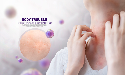 질환유발